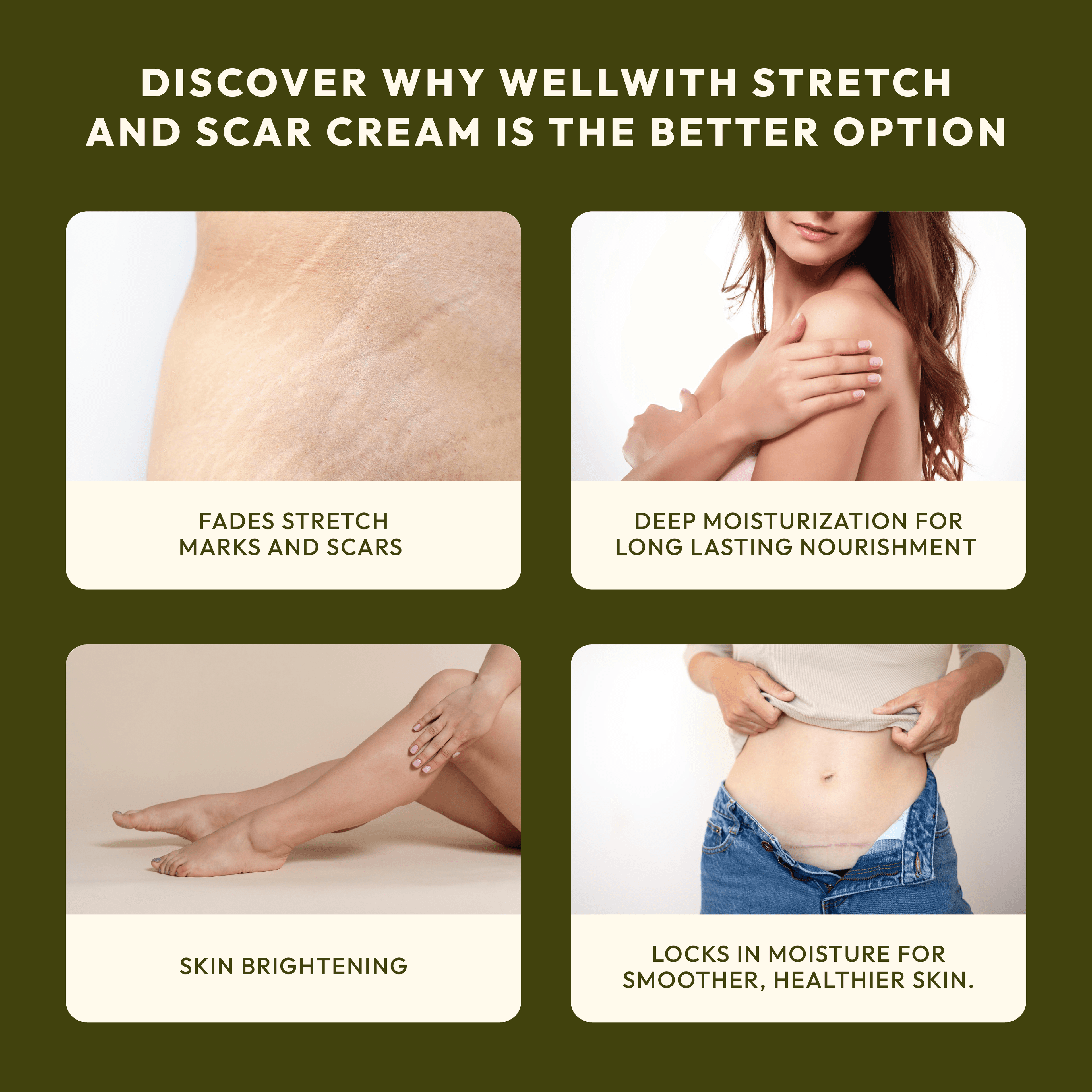 SBT Stretch & Scar Cream 50gm 4